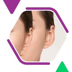 ear reconstruction