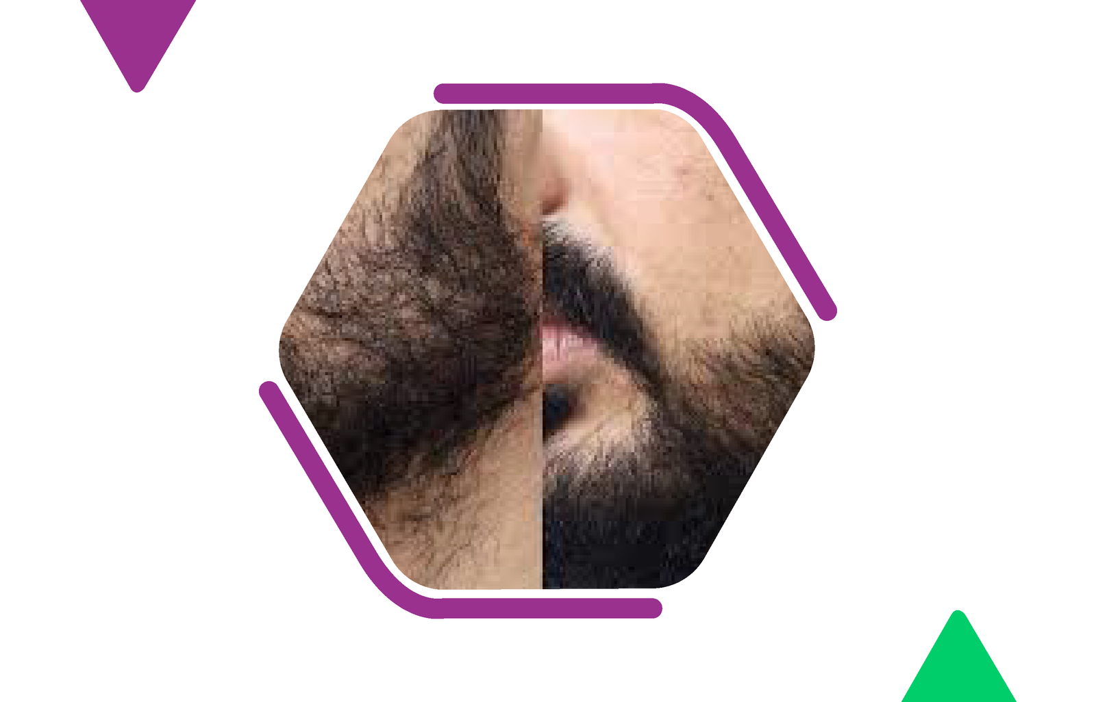 Moustache reconstruction