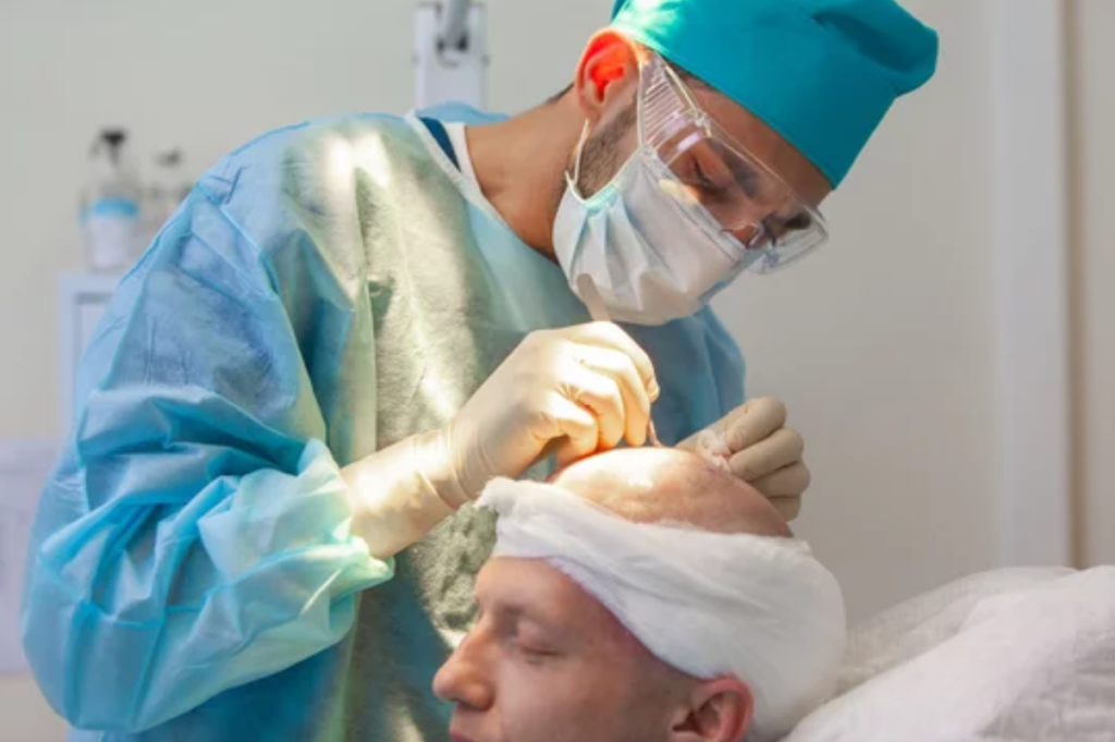 Complications of Hair Transplant Understanding Risks and Managing Outcomes 1 Plastic Surgeon in Nagpur | Cosmetic Surgeon in Nagpur | Dr. Suresh Chawre | Hair Transplant In Nagpur